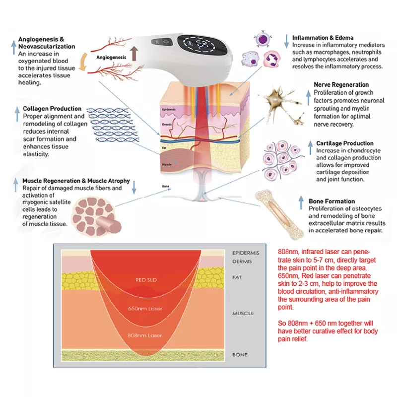 Perangkat Terapi Laser Dingin  - Pet Supplies Outlet ulasan dan harga